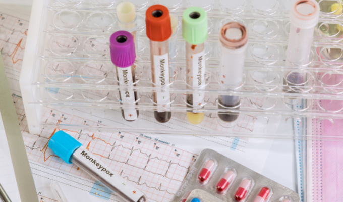 Testes para diagnóstico de varíola do macaco