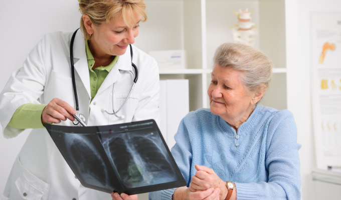 Anamnese: médica apresentando resultado de ressonância magnética para a paciente idosa